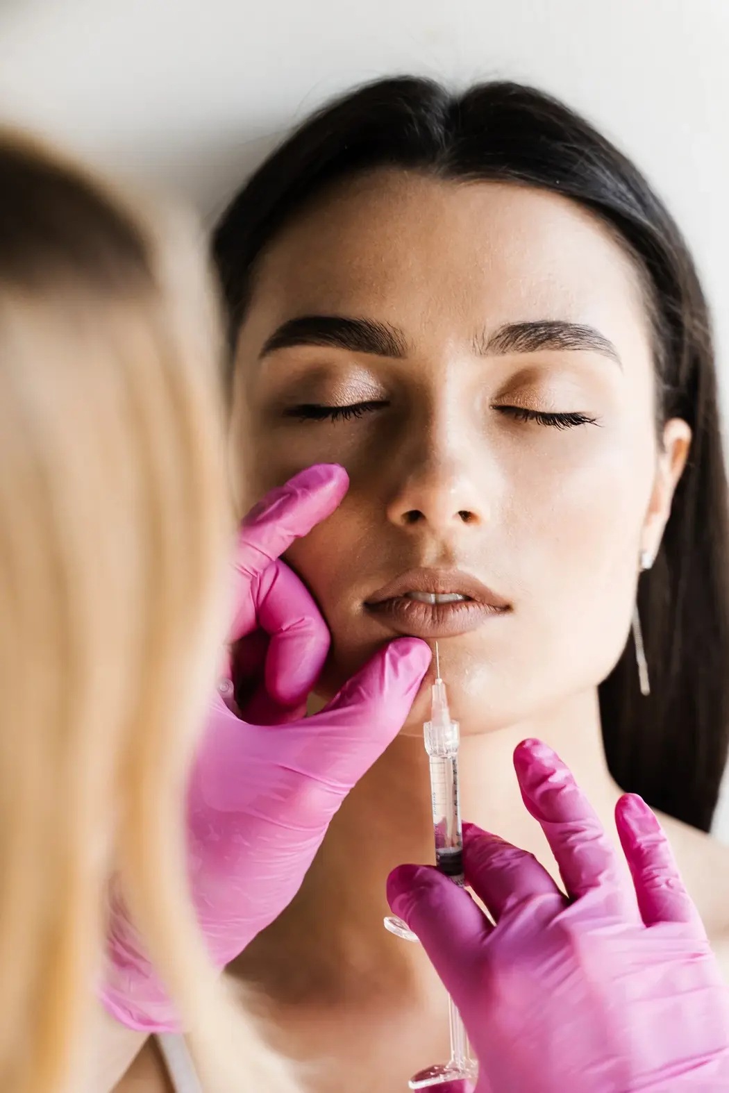 Dermal filler injection for natural facial contouring at The Natural Aesthetic & Wellness Center, Houston.