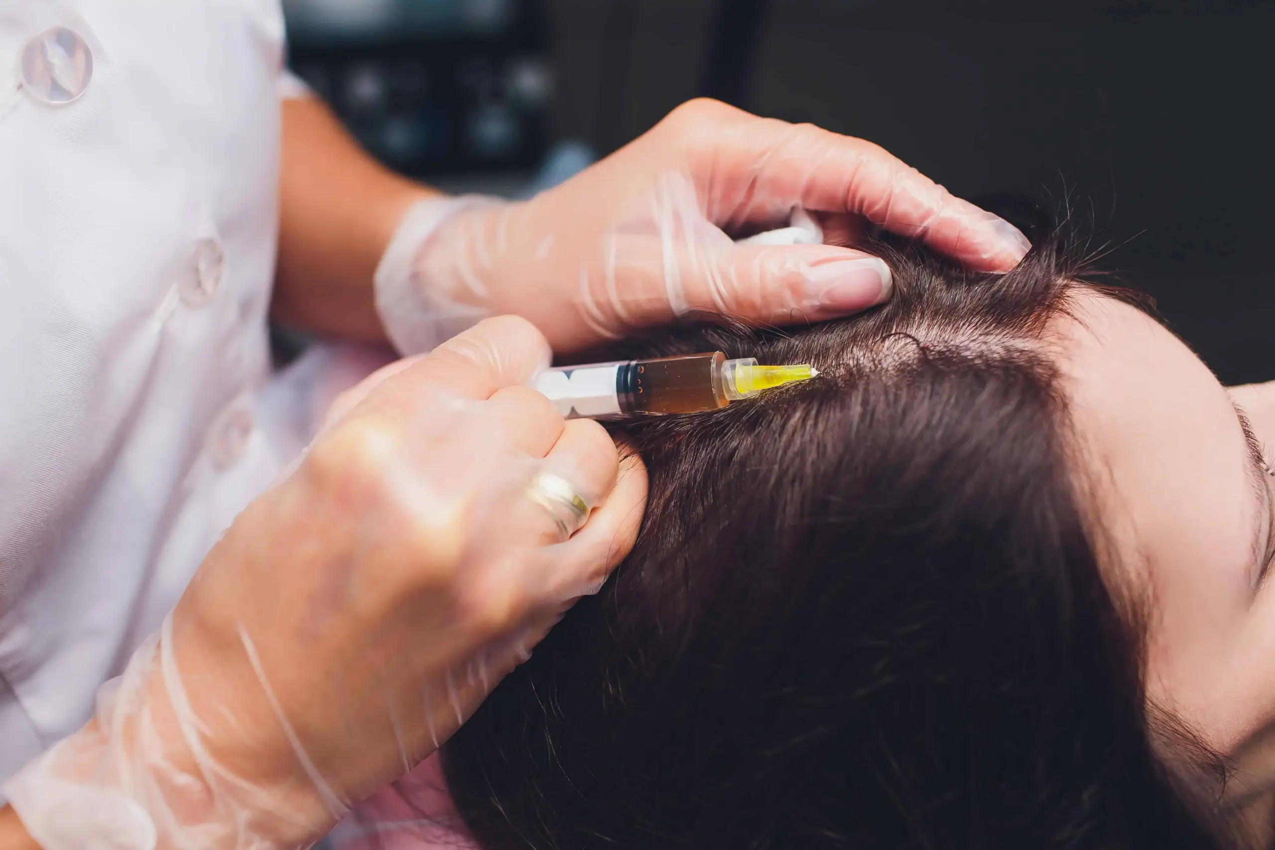 Hair Restoration Treatment in Houston, TX | The Natural Aesthetic and Wellness Center