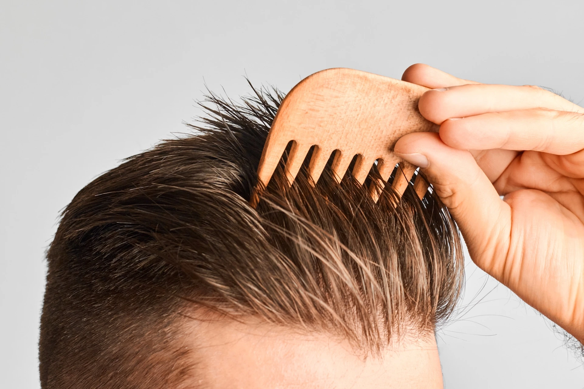 Hair Restoration in Houston, TX | The Natural Aesthetic and Wellness Center