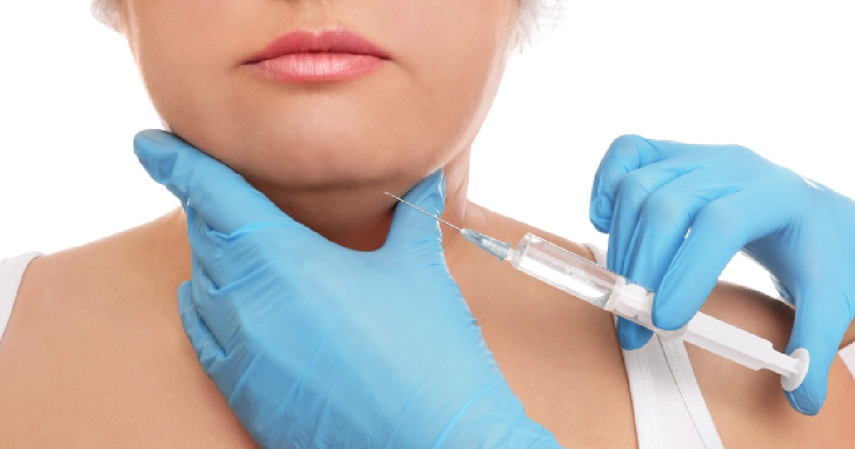 Close-up of a person receiving Kybella in Houston, TX in their chin_neck area.